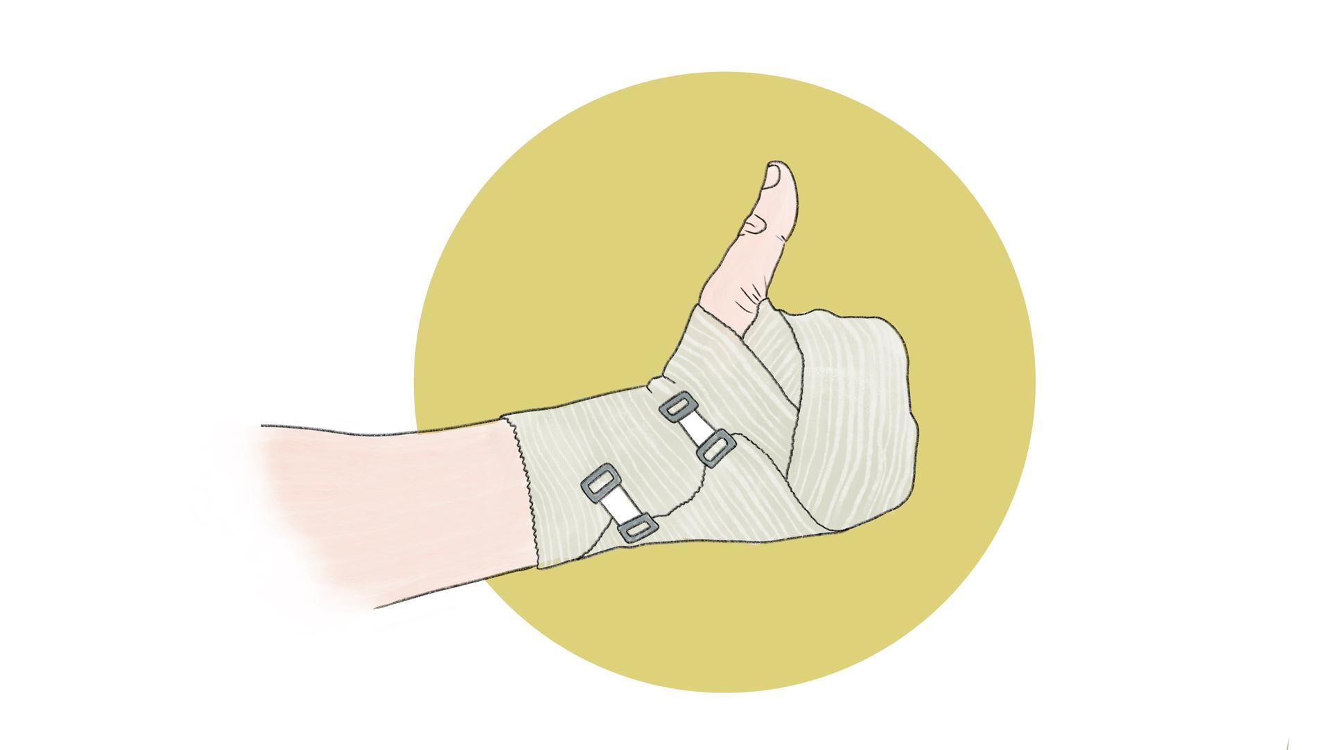 Die Illustration zeigt eine Hand mit einem Verband.